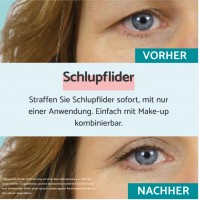 REMESCAR Schlupflider (8ml)