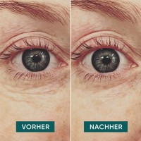 APRICOT wiederverwendbares Anti-Falten-Augen Pads mit Hyaluron (2 Stk)