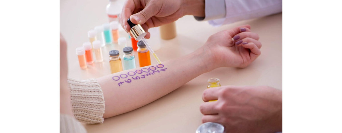 Allergien natürlich bekämpfen: Die besten Mittel und Methoden