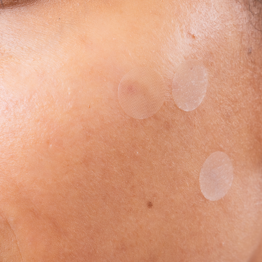 7th Heaven Men's Pimple Dots Pickelpflaster (24 Stk)