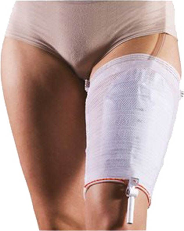 Leggyfix Beinbeutelfixierung S (10 Stk)
