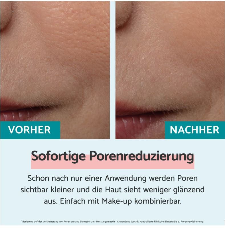 REMESCAR Sofortige Porenreduzierung (20ml)