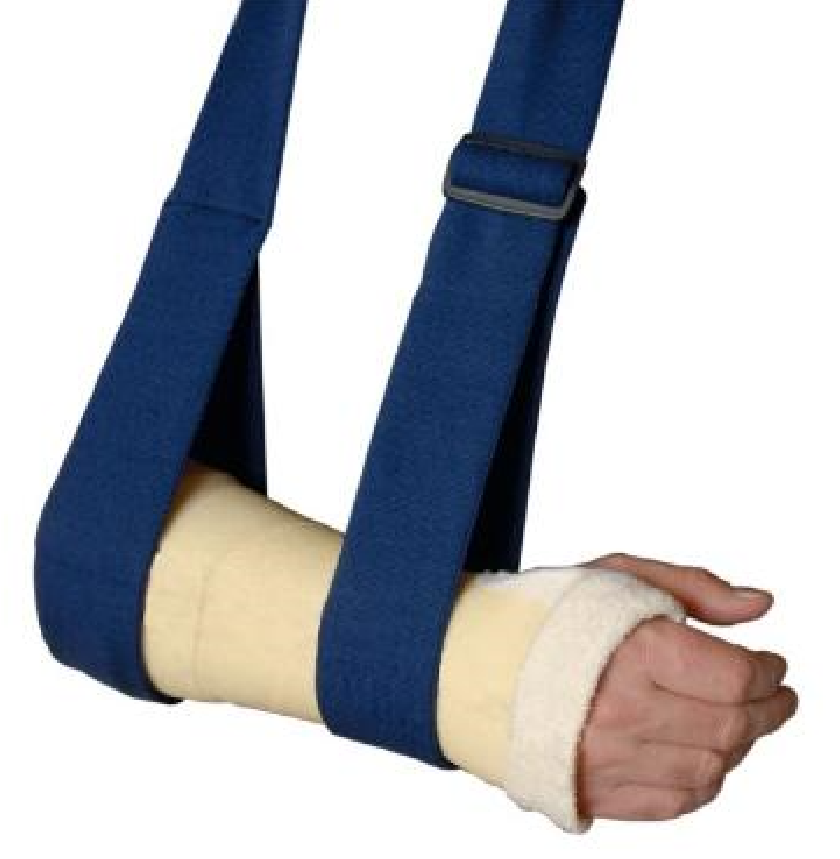 Tobler Armtragegurt 6cmx150cm blau (1 Stk)