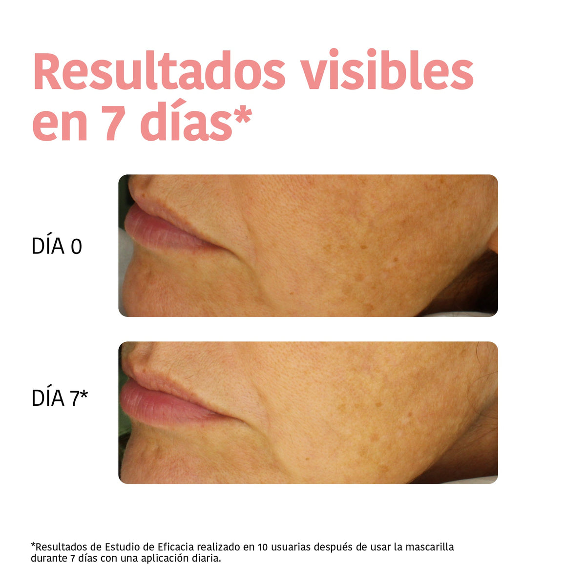 IROHA Tissue Gesichtsmaske Vitamin C und Hyaluron (1 Stk)