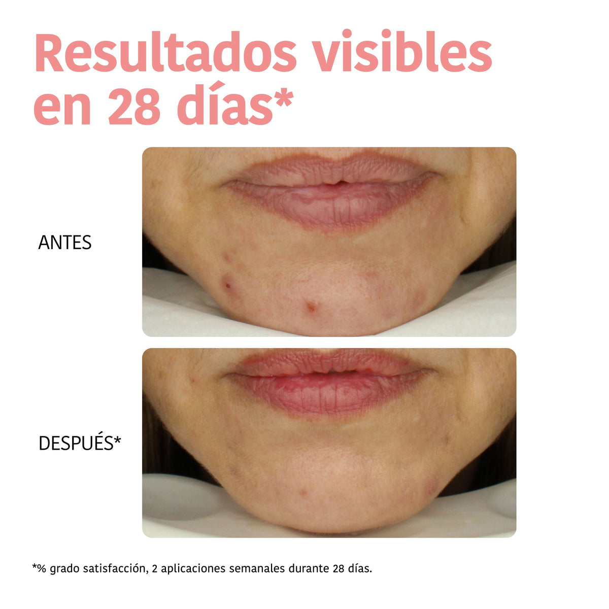 IROHA Tissue Gesichtsmaske Glycolic (20ml)