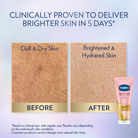 Vaseline Gluta-Hya Body Serum Dewy Radiance (200ml)