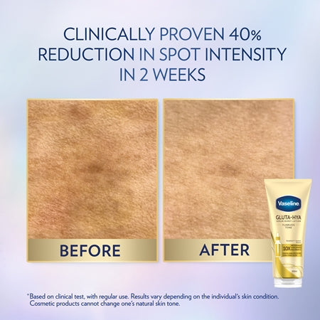 Vaseline Gluta-Hya Body Serum Flawless Tone (200ml)