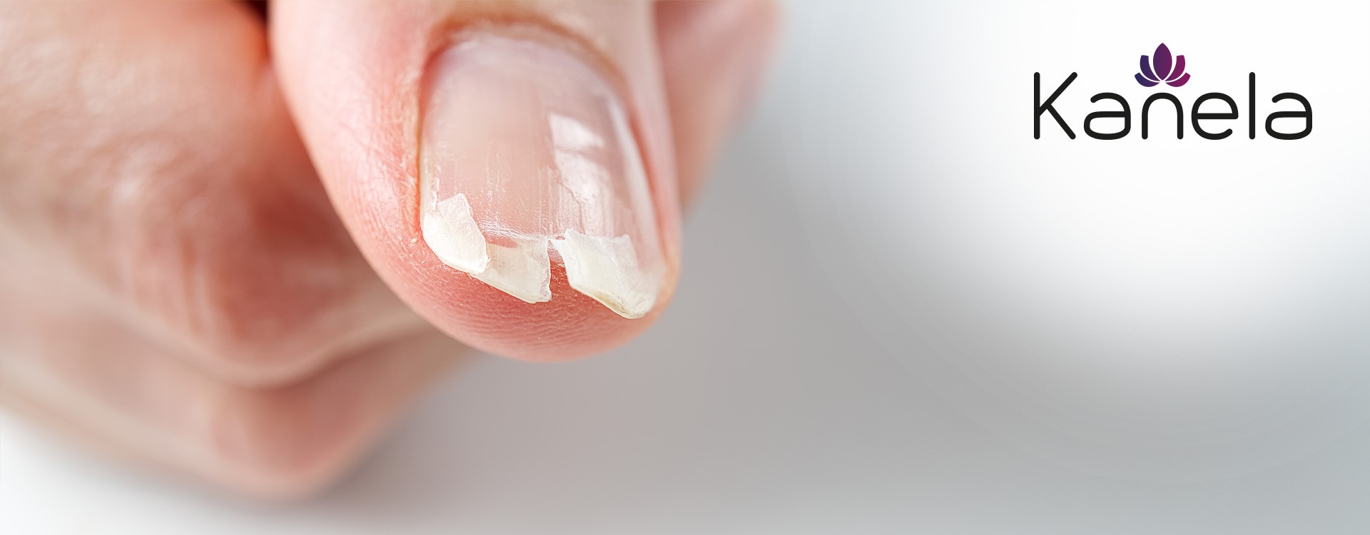 What can be done against brittle nails?
