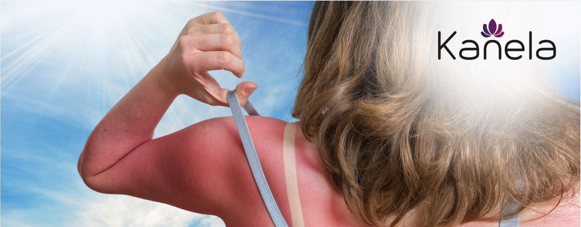 What to do against sunburn
